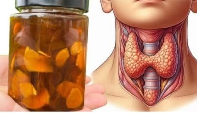 This heals your thyroid in just 3 days