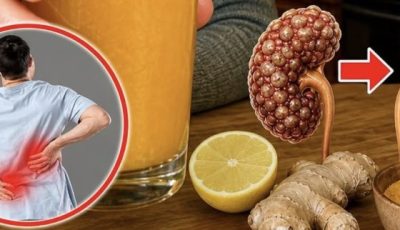It removes kidney stones, dissolves gravel, and relieves urinary tract