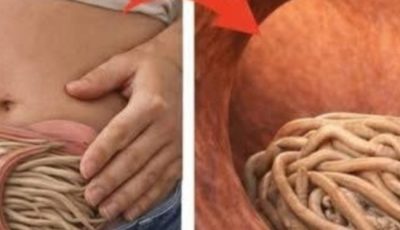 Garlic eliminates parasites in just 1 day? What you really should know before trying it