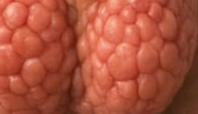 6 Simple Steps to Support Thyroid Health Naturally
