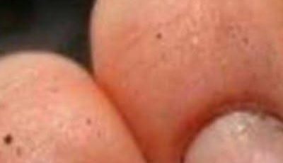 What do you call a person who has nails like that.