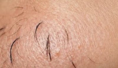 A Woman’s Chin Hair Could Be a Sign of More Than Just Aging, Experts Say