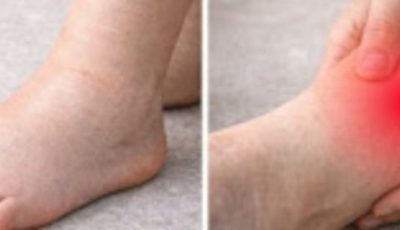 Infusion naturelle pour réduire le gonflement des jambes et des chevilles