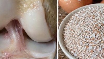 collagen, eggshells are a lifesaver. Recipe in the first comment.