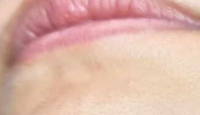 A Woman’s Chin Hair Could Be a Sign of More Than Just Aging, Experts Say