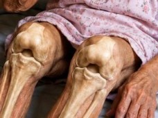 Joint Comfort Tea for Seniors: Benefits, Risks & What to Know First